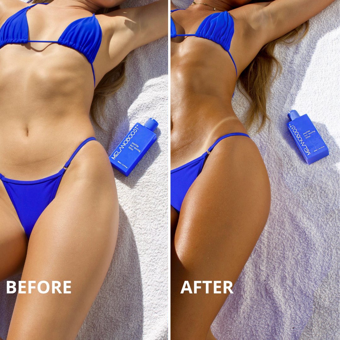 Side-by-side before and after comparison of a woman lying on a white towel, showing the tanning results after using a blue bottle of Melanoboost Peptide Sun Tanning Lotion. The left side is labeled &